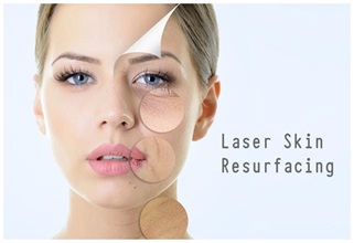 laser treatments for facial rejuvenation in udaipur