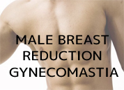 cosmetic surgery in Udaipur - male breast reduction Gynecomastia