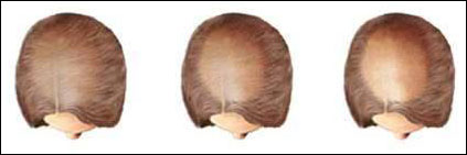Scalp Issues Doctor in Udaipur