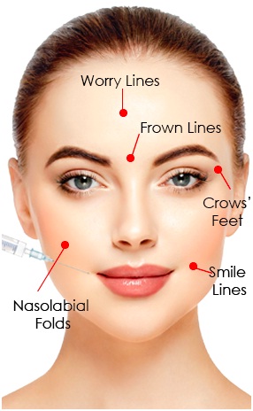 Botulinum Toxin(Botox)