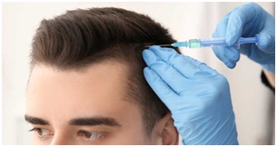 PRP Therapy For Hair Loss in Udaipur