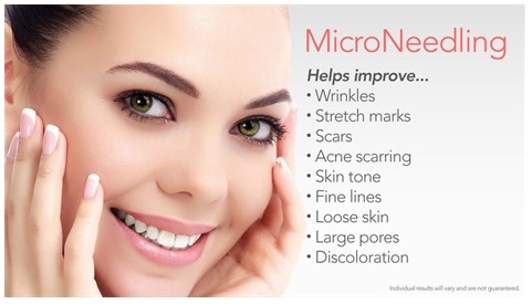 Micro Needling Treatment in Udaipur