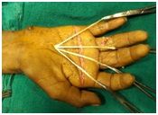 Plastic Surgery in Udaipur