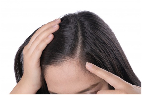 Hair loss in women